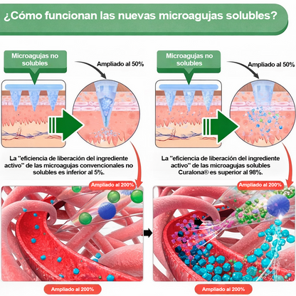 🔥 Parches de Microneedles 10 en 1 Mejorados de Curalona® — Sinergia de Berberina y NAD+ para favorecer la salud metabólica, promover la renovación cutánea y aliviar las molestias articulares — Resultados visibles en 7 días