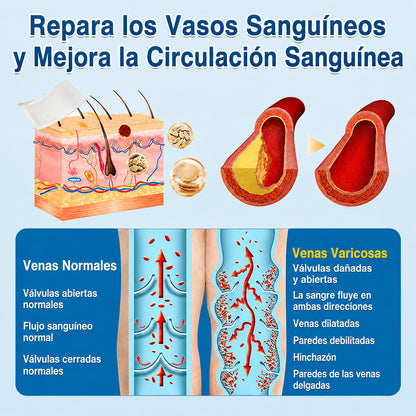 🇺🇸🏆✅️🏃 Rollo de parches de microagujas Curalona® VeinRepair ⚡ Alivio inmediato, resultados a largo plazo