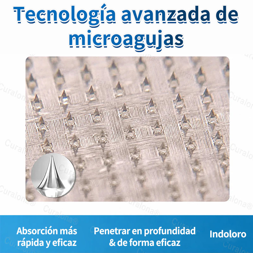 🇺🇸🏆✅️🏃 Rollo de parches de microagujas Curalona® VeinRepair ⚡ Alivio inmediato, resultados a largo plazo