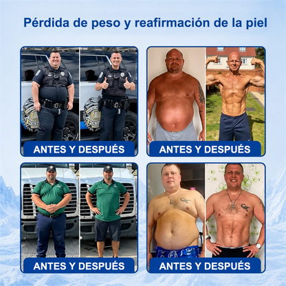 PURELORA® Bruma Cryo Sculpt 4 en 1 Tecnología de modelado de grasa adaptativo, enfriamiento inteligente, defensa de la piel y frescura.