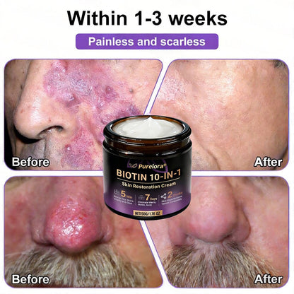 Made and Shipped from the USA 🍁 Purelora® Biotin 10-in-1 Skin Repair Cream — Last Day of Sale: 75% Off
