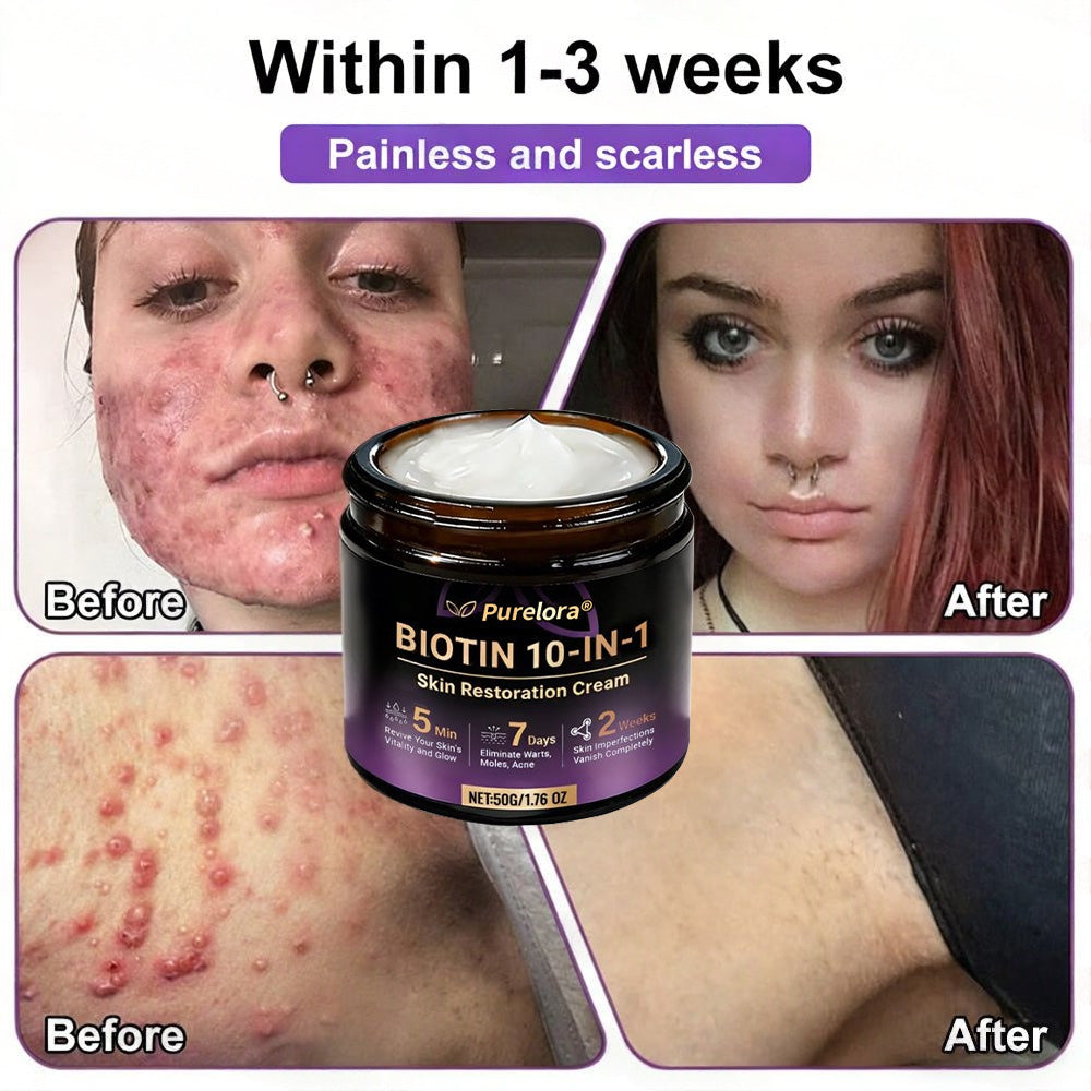 Made and Shipped from the USA 🍁 Purelora® Biotin 10-in-1 Skin Repair Cream — Last Day of Sale: 75% Off