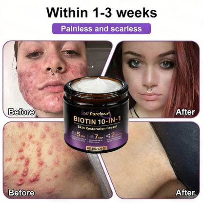 Made and Shipped from the USA 🍁 Purelora® Biotin 10-in-1 Skin Repair Cream — Last Day of Sale: 75% Off