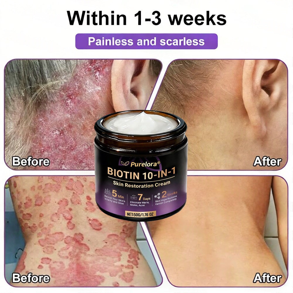 Made and Shipped from the USA 🍁 Purelora® Biotin 10-in-1 Skin Repair Cream — Last Day of Sale: 75% Off
