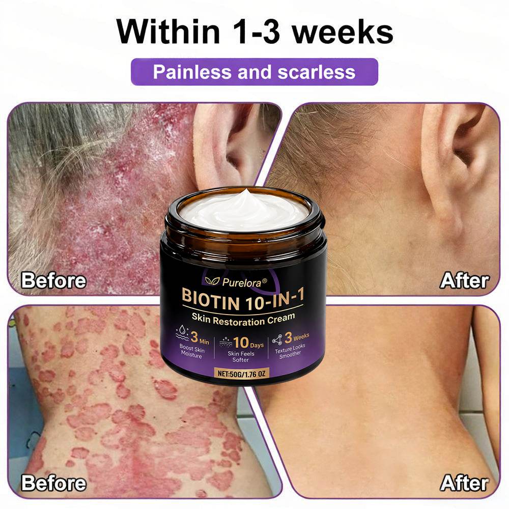 Fabricado y enviado desde EE. UU. 🍁 Purelora® Crema Reparadora de la Piel con Biotina 10 en 1 — Último día de oferta: 75% de descuento