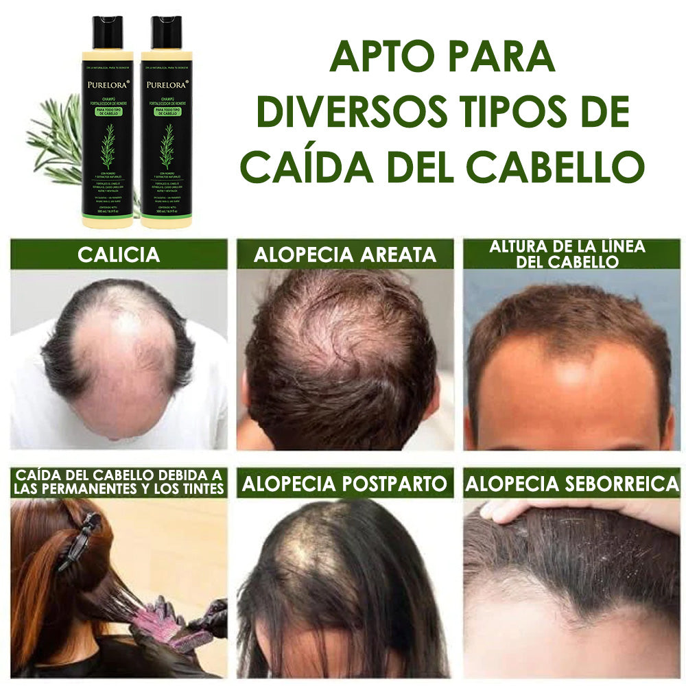 🔥ÚLTIMO DÍA 75% DE DESCUENTO⚡ Champú Purelora® de romero orgánico para el crecimiento del cabello