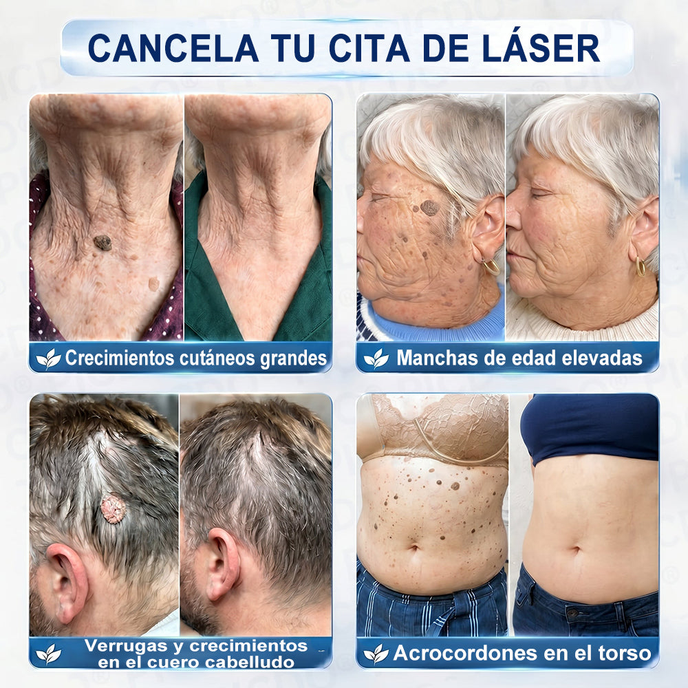 𝐏𝐔𝐑𝐄𝐋𝐎𝐑𝐀® 𝐂𝐫𝐞𝐦𝐚 𝐝𝐞 𝟕 𝐝𝐢́𝐚𝐬 𝐩𝐚𝐫𝐚 𝐞𝐥𝐢𝐦𝐢𝐧𝐚𝐫 𝐞𝐭𝐢𝐪𝐮𝐞𝐭𝐚𝐬 𝐜𝐮𝐭𝐚́𝐧𝐞𝐚𝐬 𝐲 𝐦𝐚𝐧𝐜𝐡𝐚𝐬 (𝐟𝐨́𝐫𝐦𝐮𝐥𝐚 𝐬𝐢𝐧 𝐝𝐨𝐥𝐨𝐫, 𝐬𝐢𝐧 𝐜𝐢𝐜𝐚𝐭𝐫𝐢𝐜𝐞𝐬) 🌹🌹