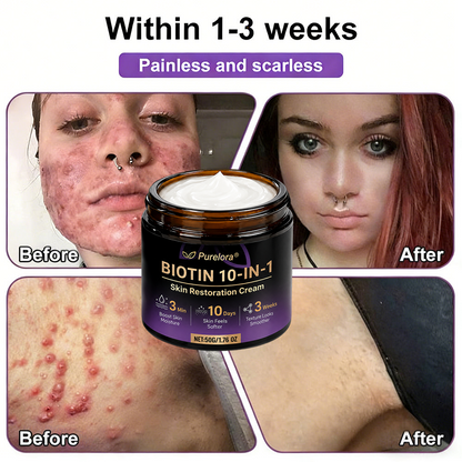 Fabricado y enviado desde EE. UU. 🍁 Purelora® Crema Reparadora de la Piel con Biotina 10 en 1 — Último día de oferta: 75% de descuento