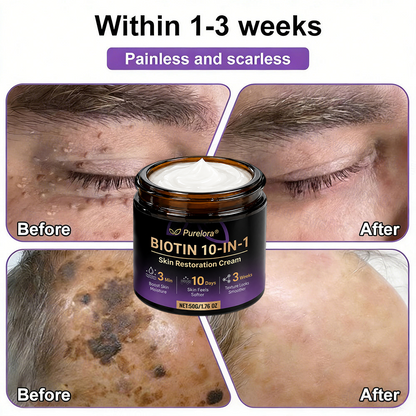 Fabricado y enviado desde EE. UU. 🍁 Purelora® Crema Reparadora de la Piel con Biotina 10 en 1 — Último día de oferta: 75% de descuento