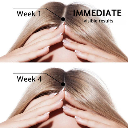 🌿👨‍⚕️ Official US Store 🇺🇸 | 🔥 PURELORA® Onion & Rosemary 2-in-1 Shampoo & Conditioner with 15X Active Complex for Hair Growth: For hair that looks thicker, fuller, and stronger