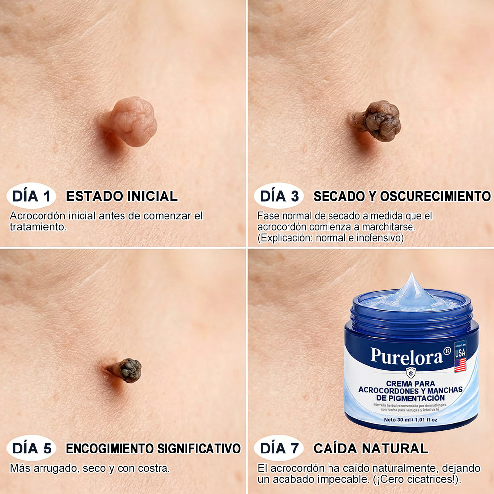 𝐏𝐔𝐑𝐄𝐋𝐎𝐑𝐀® 𝐂𝐫𝐞𝐦𝐚 𝐝𝐞 𝟕 𝐝𝐢́𝐚𝐬 𝐩𝐚𝐫𝐚 𝐞𝐥𝐢𝐦𝐢𝐧𝐚𝐫 𝐞𝐭𝐢𝐪𝐮𝐞𝐭𝐚𝐬 𝐜𝐮𝐭𝐚́𝐧𝐞𝐚𝐬 𝐲 𝐦𝐚𝐧𝐜𝐡𝐚𝐬 (𝐟𝐨́𝐫𝐦𝐮𝐥𝐚 𝐬𝐢𝐧 𝐝𝐨𝐥𝐨𝐫, 𝐬𝐢𝐧 𝐜𝐢𝐜𝐚𝐭𝐫𝐢𝐜𝐞𝐬) 🌹🌹