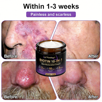 Fabricado y enviado desde EE. UU. 🍁 Purelora® Crema Reparadora de la Piel con Biotina 10 en 1 — Último día de oferta: 75% de descuento