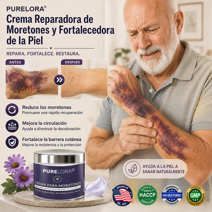 💥Over 100,000 units sold💕 - PURELORA® cream to repair bruises and strengthen the skin