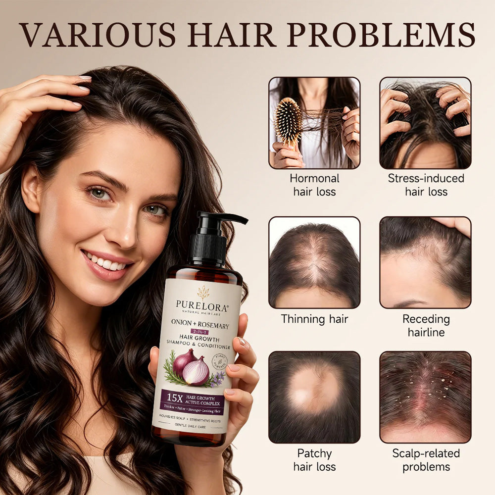 🌿👨‍⚕️ Official US Store 🇺🇸 | 🔥 PURELORA® Onion & Rosemary 2-in-1 Shampoo & Conditioner with 15X Active Complex for Hair Growth: For hair that looks thicker, fuller, and stronger
