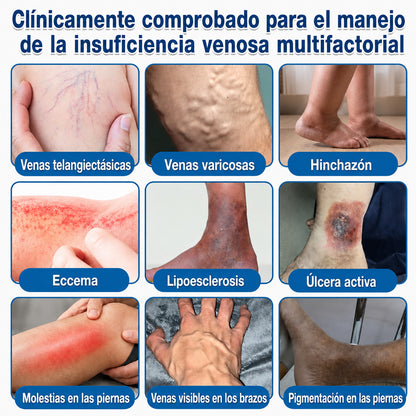 🇺🇸🏆✅️🏃 Rollo de parches de microagujas Curalona® VeinRepair ⚡ Alivio inmediato, resultados a largo plazo