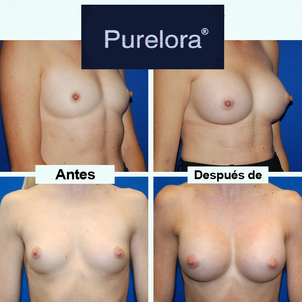 【Tienda Oficial】Purelora® Parche 5 en 1 para el Levantamiento y Reafirmación del Busto con Aceite de Bakuchiol