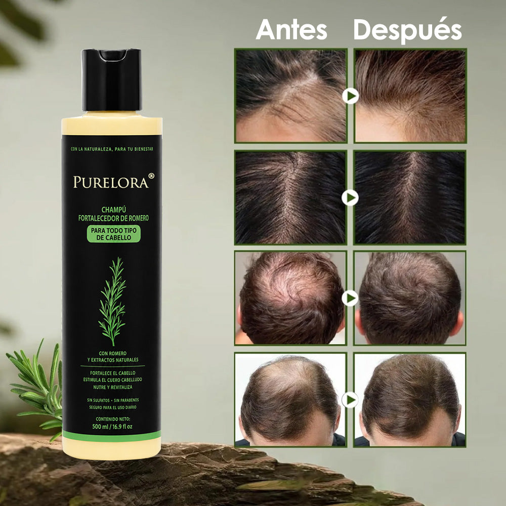 🔥ÚLTIMO DÍA 75% DE DESCUENTO⚡ Champú Purelora® de romero orgánico para el crecimiento del cabello