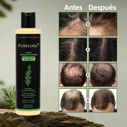 🔥ÚLTIMO DÍA 75% DE DESCUENTO⚡ Champú Purelora® de romero orgánico para el crecimiento del cabello