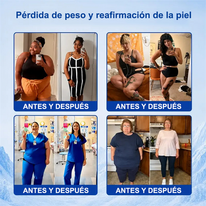 PURELORA® Bruma Cryo Sculpt 4 en 1 Tecnología de modelado de grasa adaptativo, enfriamiento inteligente, defensa de la piel y frescura.