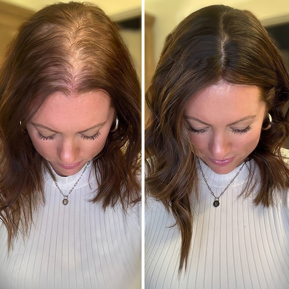 🌿👨‍⚕️ Tienda oficial en EE. UU. 🇺🇸 | 🔥 Champú y acondicionador 2 en 1 PURELORA® de cebolla y romero con complejo activo 15X para el crecimiento capilar: para un cabello con apariencia más gruesa, abundante y fuerte.